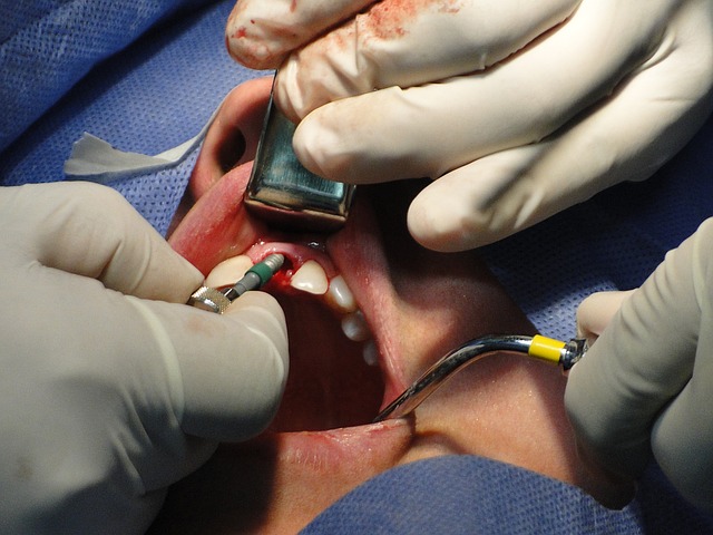 שתלים ביום אחד